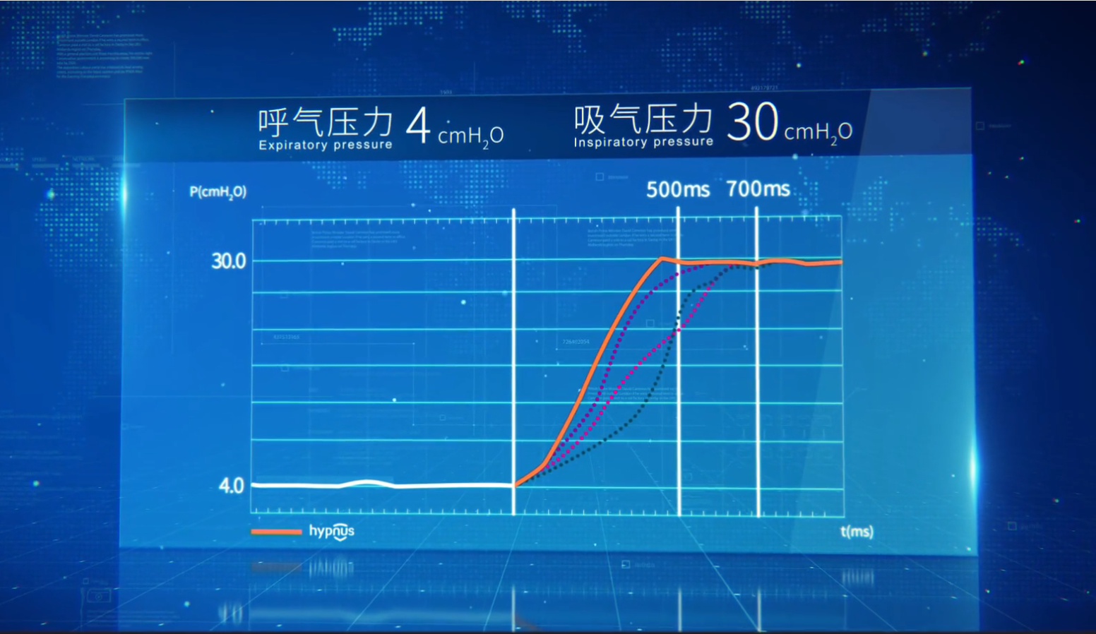 朝野医疗CA820M呼吸机正式上市